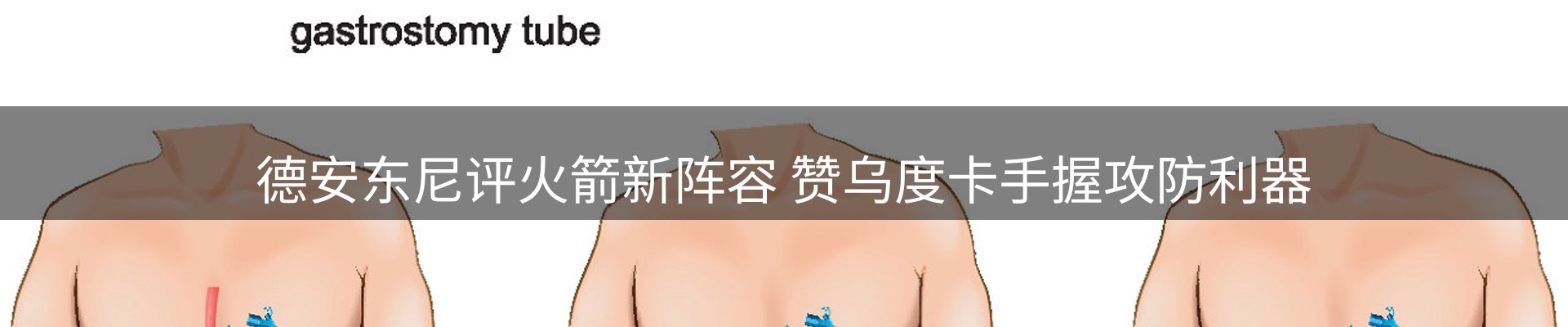 新闻解析